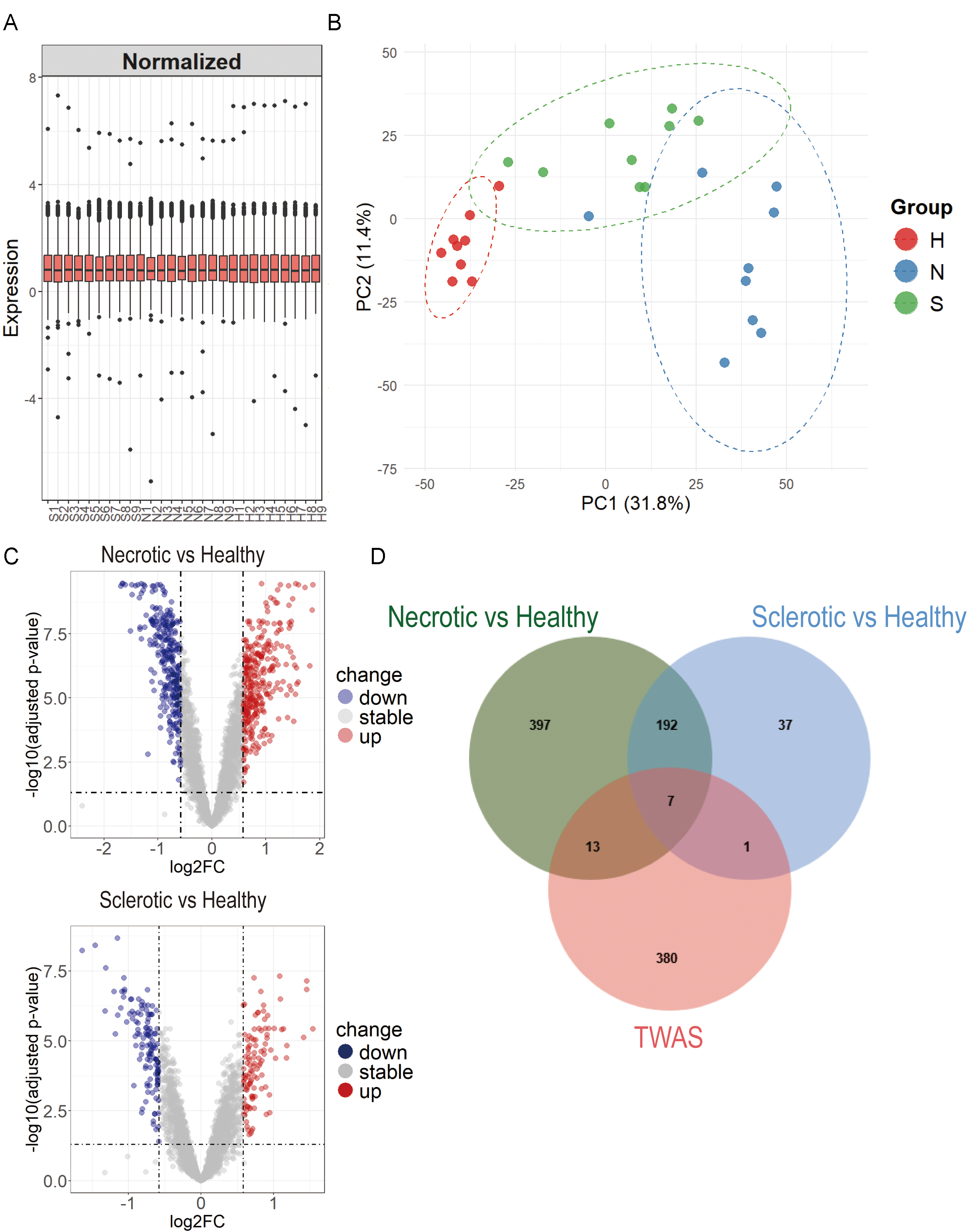 Analysis of differentially expressed proteins (DEPs) and prioritization of genetic candidates for MR analyses. (A) Boxplot of proteomic data following variance-stabilizing normalization. (B) PCA plot showing distinct clustering of necrotic, sclerotic, and healthy tissues. (C) Volcano plots illustrating DEPs: Top, necrotic vs. healthy (n = 609); bottom, sclerotic vs. healthy (n = 237). Red points indicate upregulated proteins; blue points indicate downregulated proteins. (D) Venn diagram showing the 21 genes overlapping between TWAS and proteomics results, prioritized for MR analysis.